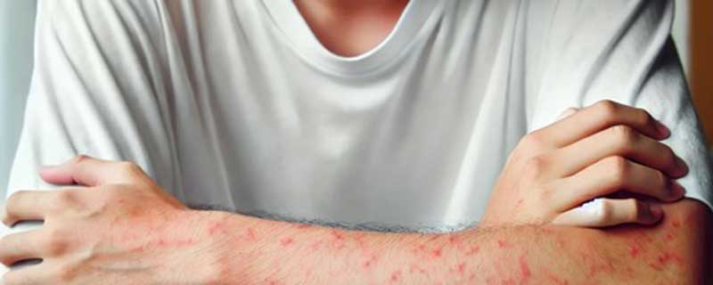 allergie_800x320